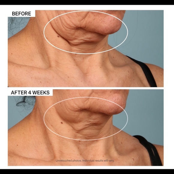 COPY - StriVectin neck firming cream - Picture 7 of 8